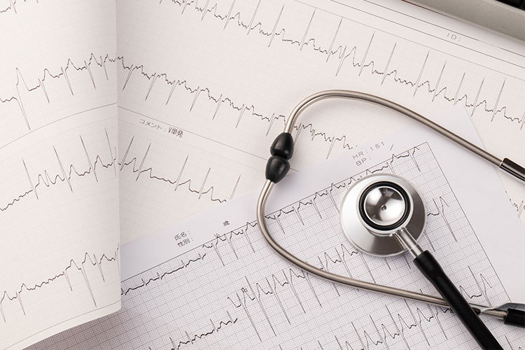 循環器内科画像